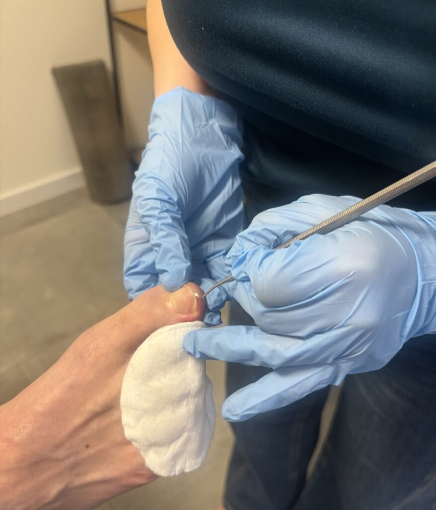 Sportpedicure (verzorgend)